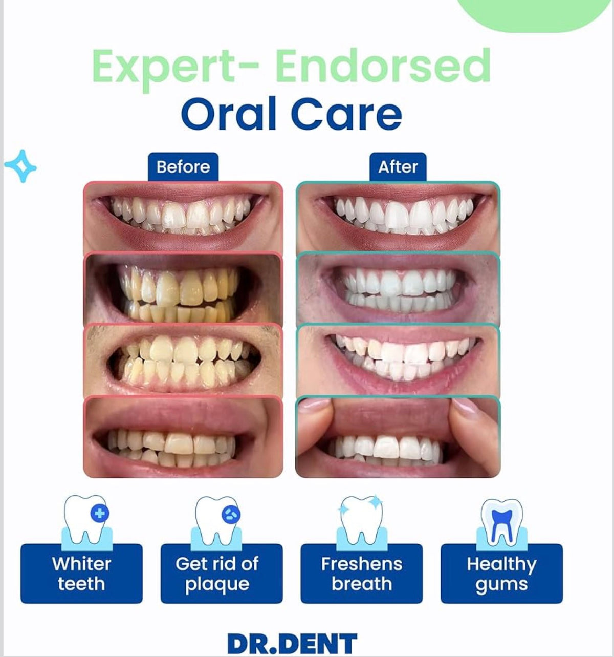 Radiant Whitening & Ultra-Effective Care for Sensitive Teeth
