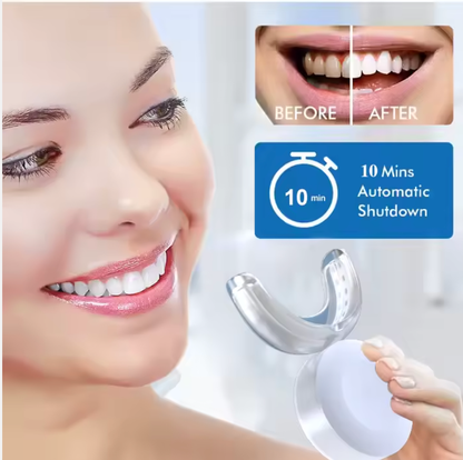 "Sensitive Teeth Immediate Effect" Whitening Kit, 90 days, #1⭐️🏅